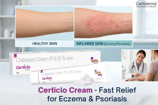 Certiclo Cream for Eczema & Psoriasis: Fast Relief with Clobetasol Propionate 0.05%