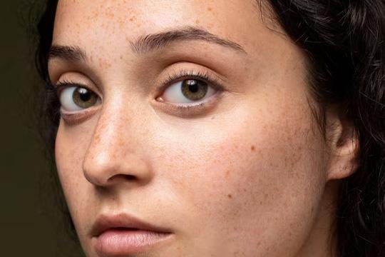 Skin Brightening Guide: How to Reduce Pigmentation & Get Even Skin Tone